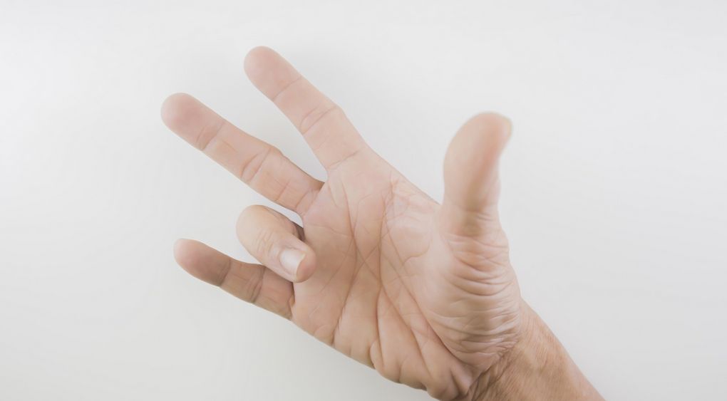 Strzelający palec, kciuk (przeskakujący, trzaskający, zatrzaskujący) – leczenie, operacja, rehabilitacja